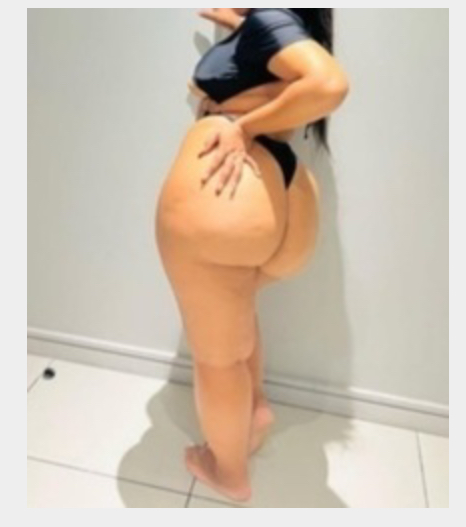 Missing Profile Picture