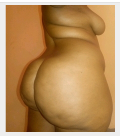 Missing Profile Picture