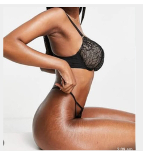 Missing Profile Picture